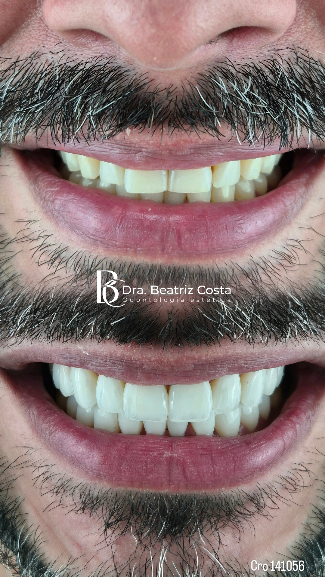 Sorriso antes e depois — estética e harmonia